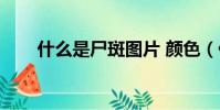 什么是尸斑圖片 顏色(什么是尸斑)