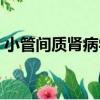 小管間質腎病學（關于小管間質腎病學簡介）