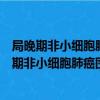 局晚期非小細胞肺癌圍手術期免疫治療專家共識（關于局晚期非小細胞肺癌圍手術期免疫治療專家共識簡介）