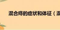混合痔的癥狀和體征(混合痔的癥狀)