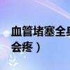 血管堵塞全身會痛嗎（血管堵塞的人身體3處會疼）