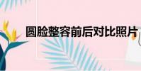 圓臉整容前后對比照片(圓臉整容)