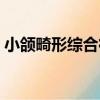 小頜畸形綜合征（關于小頜畸形綜合征簡介）