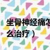 坐骨神經痛怎么治療方法最快（坐骨神經痛怎么治療）