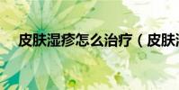 皮膚濕疹怎么治療(皮膚濕疹怎么治療)