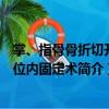 掌、指骨骨折切開復位內固定術（關于掌、指骨骨折切開復位內固定術簡介）