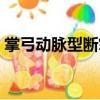掌弓動脈型斷掌（關于掌弓動脈型斷掌簡介）