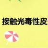 接觸光毒性皮炎（關于接觸光毒性皮炎簡介）
