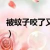 被蚊子咬了又疼又癢（被蚊子咬了好幾天還癢）