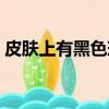 皮膚上有黑色斑塊怎么回事（空間黑色皮膚）