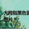 大拇指黑色豎紋怎么回事（大拇指有黑色豎紋圖片）