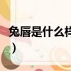 兔唇是什么樣子的唇（兔唇是什么樣子的圖片）