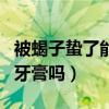 被蝎子蟄了能用白酒消毒嗎（被蝎子蟄了能用牙膏嗎）