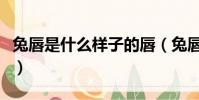 兔唇是什么樣子的唇(兔唇是什么樣子的圖片)