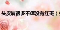 頭皮屑很多不癢沒有紅斑(頭皮屑很多不癢)