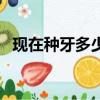 現在種牙多少錢（現在換一顆牙要多少錢）