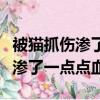 被貓抓傷滲了一點點血需要打疫苗（被貓抓傷滲了一點點血）