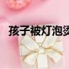孩子被燈泡燙傷怎么辦（小學生被燈灼傷）