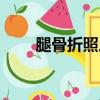 腿骨折照片真實圖片（腿骨折照片）