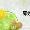 屎姓的歷史名人（屎姓）