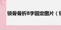 鎖骨骨折8字固定圖片(鎖骨骨折圖片)