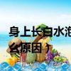 身上長白水泡是什么原因（身上起白水泡是什么原因）