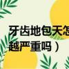 牙齒地包天怎么矯正最佳時間（地包天會越來越嚴重嗎）