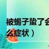 被蝎子蟄了會出現什么癥狀（被蝎子蟄了有什么癥狀）
