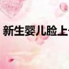 新生嬰兒臉上長濕疹怎么辦（長濕疹怎么辦）