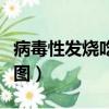 病毒性發燒吃什么食物（病毒性發燒后出疹子圖）