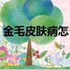 金毛皮膚病怎么治除根（皮膚病怎么治除根）