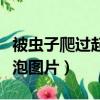 被蟲子爬過起水泡圖片大全（被蟲子爬過起水泡圖片）