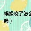 蜈蚣咬了怎么處理方法（被蜈蚣咬了有后遺癥嗎）