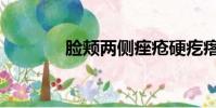 臉頰兩側痤瘡硬疙瘩(臉頰)