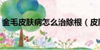 金毛皮膚病怎么治除根(皮膚病怎么治除根)