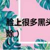 臉上很多黑頭粉刺怎么去除（黑頭粉刺怎么去除）