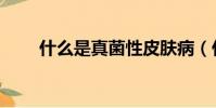 什么是真菌性皮膚病(什么是真菌)