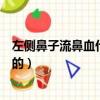左側鼻子流鼻血什么原因導致的（鼻子流鼻血什么原因導致的）