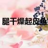 腿干燥起皮魚鱗狀發白（腿干燥起皮怎么辦）