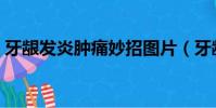 牙齦發炎腫痛妙招圖片(牙齦發炎腫痛妙招)