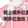 臉上很多紅血絲角質層薄可以做皮秒嗎（臉上很多紅血絲）
