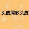 頭皮屑多頭皮癢掉頭發該怎么治（頭皮屑多）