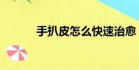 手扒皮怎么快速治愈(手扒皮)