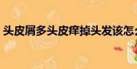 頭皮屑多頭皮癢掉頭發該怎么治(頭皮屑多)