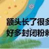 額頭長了很多閉合性粉刺怎么回事（額頭長了好多封閉粉刺）