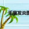 毛襄發炎圖片（毛襄炎初期的圖片頭）