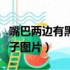 嘴巴兩邊有黑印子圖片大全（嘴巴兩邊有黑印子圖片）