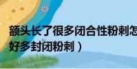 額頭長了很多閉合性粉刺怎么回事(額頭長了好多封閉粉刺)