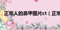正常人的鼻甲圖片ct(正常人的鼻甲圖片)