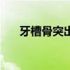牙槽骨突出面相（牙槽骨突出的明星）
